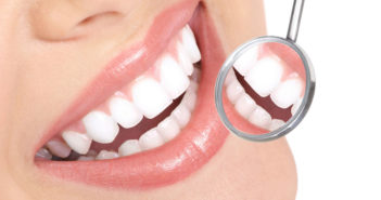 Come sbiancare i denti in modo naturale: i metodi fai da te più efficaci