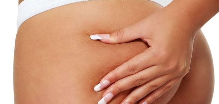 Come eliminare la cellulite in modo naturale cosce e glutei - Scopri come eliminare la cellulite in poco tempo e definitivamente